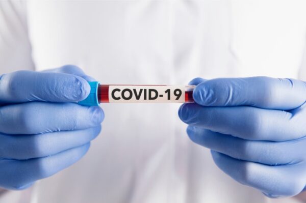 COVID-19 Antibody Test