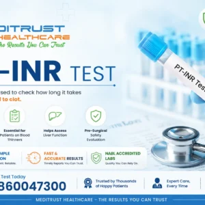 Prothrombin Time (PT-INR) Test