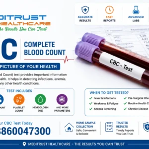 Complete Blood Count (CBC) Test