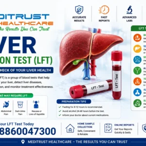Liver Function Test (LFT)